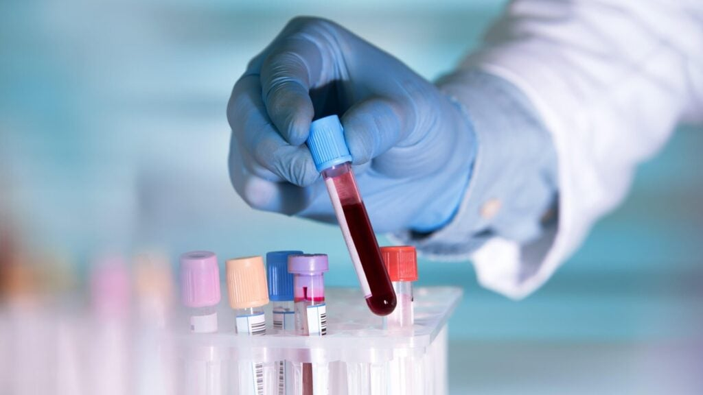 Study Suggests AI-Generated Drug Could Slow Aging
