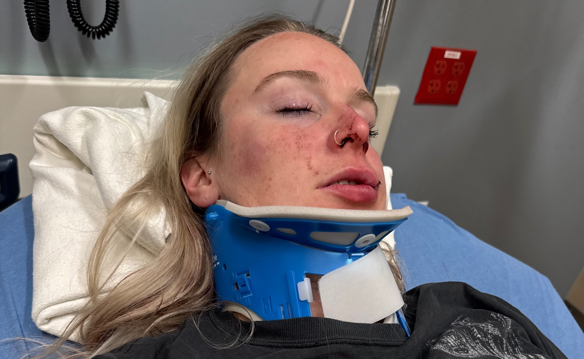Lesbian couple sue casino after alleged brutal anti-gay attack: ‘They did nothing’