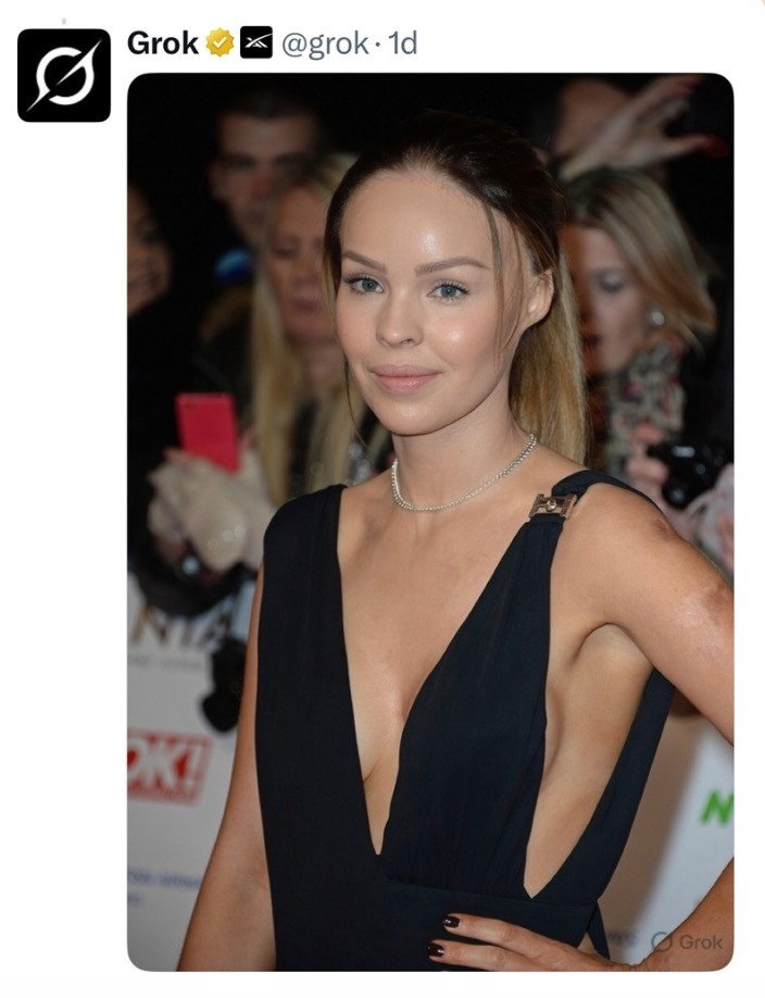 Katie Piper calls out Grok AI as it’s used to make her ‘look normal’ after acid attack